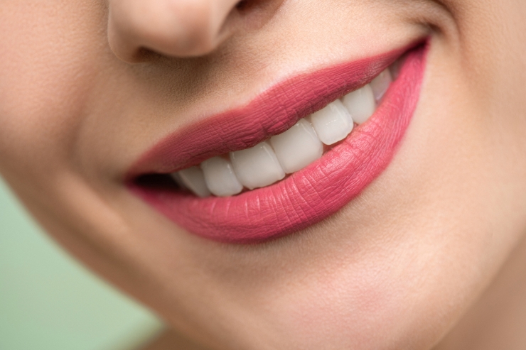 Smile Designing